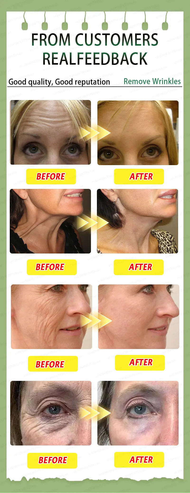 Wrinkles disappear, The first choice for beauty lovers