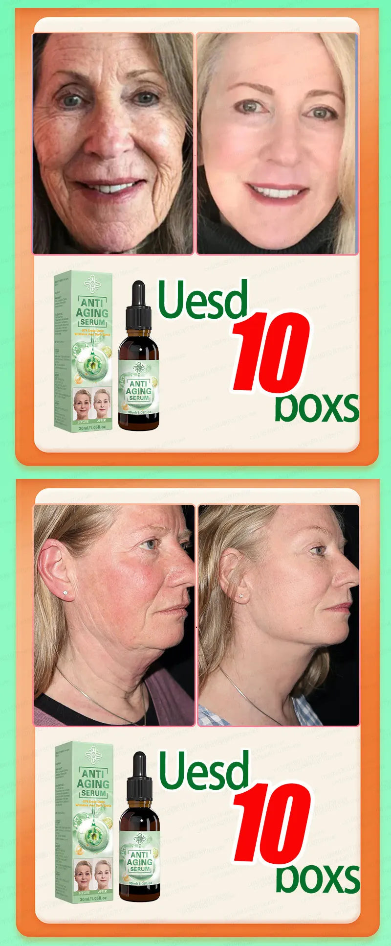 Wrinkles disappear, The first choice for beauty lovers