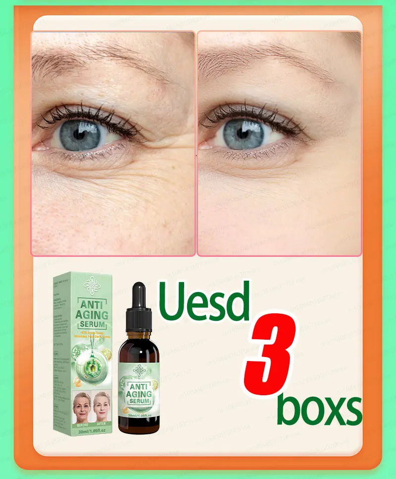 Wrinkles disappear, The first choice for beauty lovers