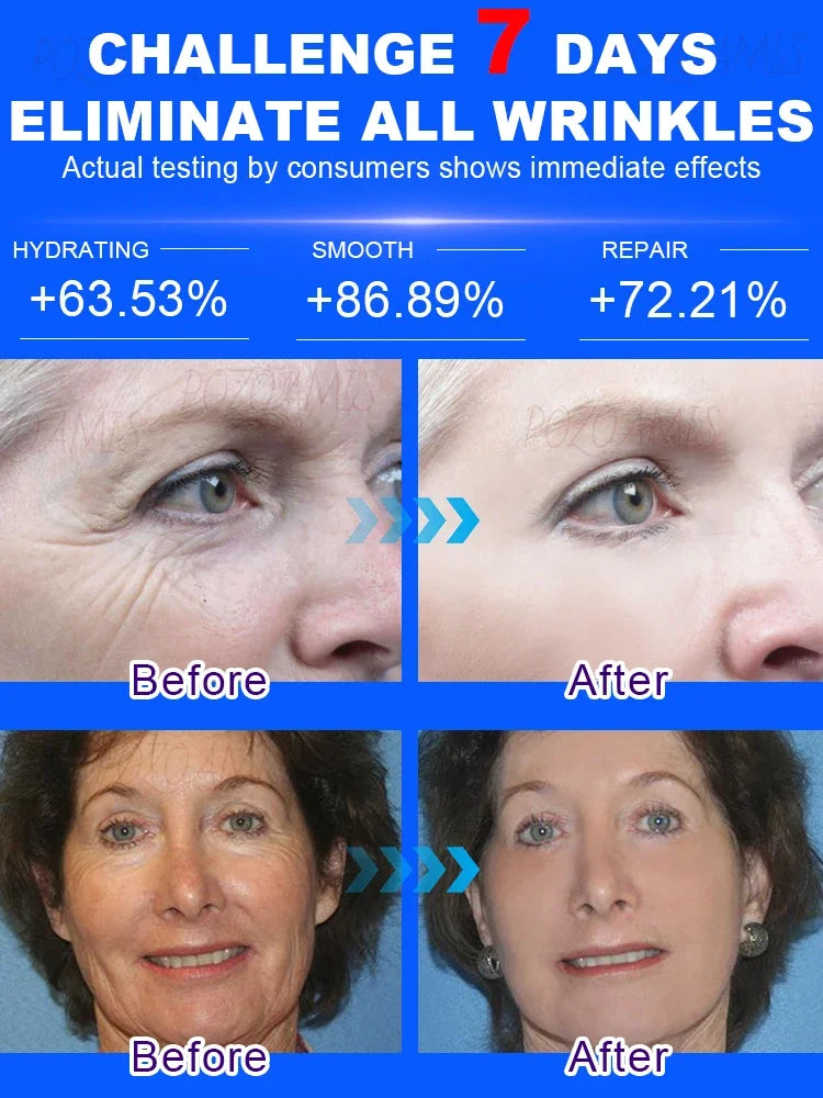 Wrinkles disappear, The first choice for beauty lovers