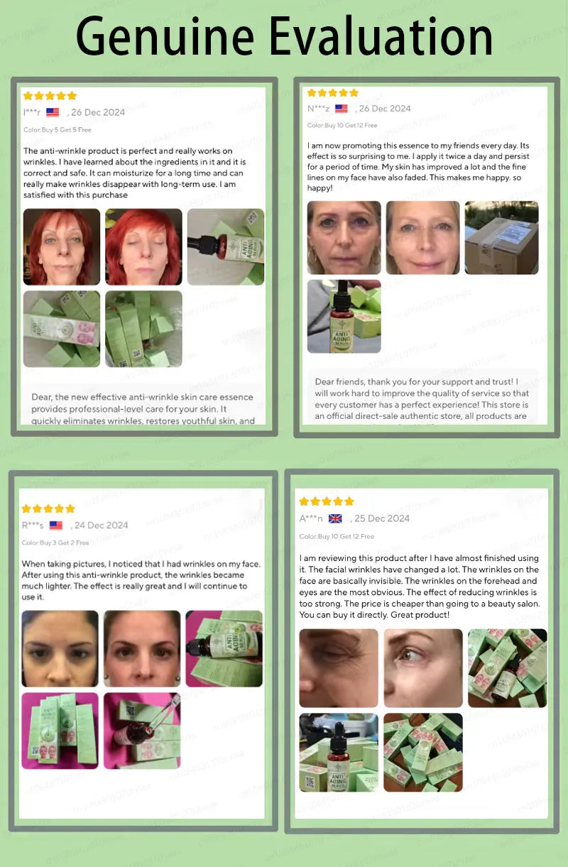 Wrinkles disappear, The first choice for beauty lovers