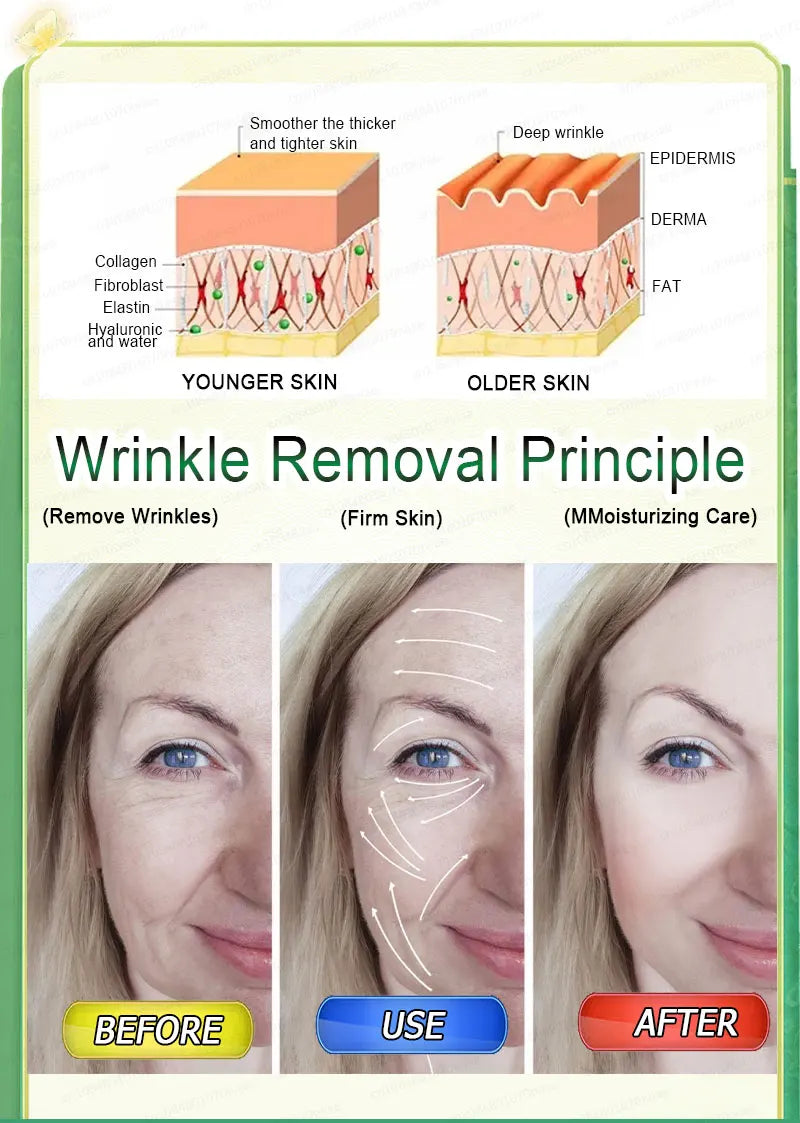 Wrinkles disappear, The first choice for beauty lovers